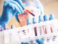Quy trình xử lý chống phơi nhiễm HIV