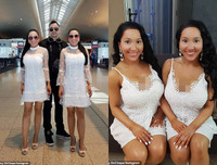 Cặp chị em song sinh chung bạn trai 8 năm tiếc nuối nhan sắc quá khứ vì thẩm mỹ quá đà