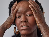 [ẢNH] Những phụ nữ đẹp lạ lùng, phá vỡ chuẩn mực sắc đẹp của thế giới