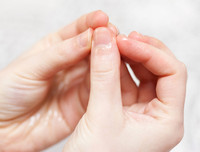 [ẢNH] 12 dấu hiệu bất thường trên cơ thể 