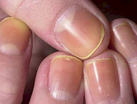 [ẢNH] 12 dấu hiệu bất thường trên cơ thể 