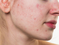 [ẢNH] Cảnh báo những căn bệnh dễ mắc phải khi trời nồm ẩm và cách phòng tránh