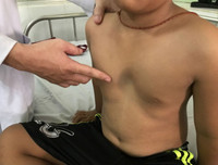 Nhận biết sớm những dấu hiệu viêm phổi để cả nhà 