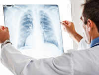 Nhận biết sớm những dấu hiệu viêm phổi để cả nhà 