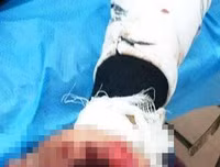 [ẢNH] Nguy hiểm chết người của việc dùng điện thoại khi sạc