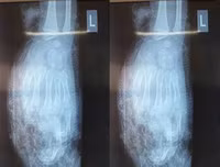 [ẢNH] Nguy hiểm chết người của việc dùng điện thoại khi sạc