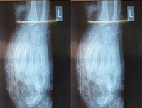 [ẢNH] Nguy hiểm chết người của việc dùng điện thoại khi sạc