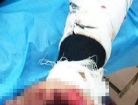 [ẢNH] Nguy hiểm chết người của việc dùng điện thoại khi sạc