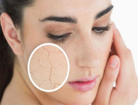 7 tác hại đáng sợ của tia UV đối với cơ thể