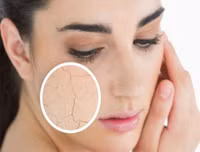 7 tác hại đáng sợ của tia UV đối với cơ thể