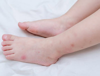 [ẢNH] Hạ sốt an toàn cho trẻ bằng các mẹo dân gian