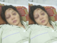 Toàn bộ vụ việc thai phụ 18 tuổi bị tra tấn dã man đến sảy thai ở TP.HCM