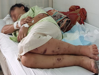 Toàn bộ vụ việc thai phụ 18 tuổi bị tra tấn dã man đến sảy thai ở TP.HCM