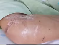 Toàn bộ vụ việc thai phụ 18 tuổi bị tra tấn dã man đến sảy thai ở TP.HCM