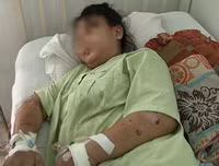 Toàn bộ vụ việc thai phụ 18 tuổi bị tra tấn dã man đến sảy thai ở TP.HCM