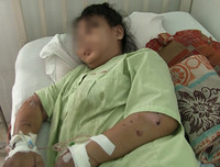 Toàn bộ vụ việc thai phụ 18 tuổi bị tra tấn dã man đến sảy thai ở TP.HCM