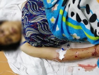 Toàn bộ vụ việc thai phụ 18 tuổi bị tra tấn dã man đến sảy thai ở TP.HCM