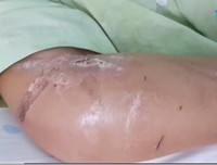 Toàn bộ vụ việc thai phụ 18 tuổi bị tra tấn dã man đến sảy thai ở TP.HCM