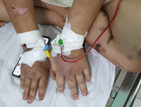 Toàn bộ vụ việc thai phụ 18 tuổi bị tra tấn dã man đến sảy thai ở TP.HCM