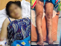 Toàn bộ vụ việc thai phụ 18 tuổi bị tra tấn dã man đến sảy thai ở TP.HCM