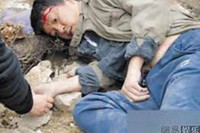 [ẢNH] Tai nạn phim trường - những điều không thể ngờ tới