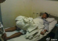 [ẢNH] Tai nạn phim trường - những điều không thể ngờ tới