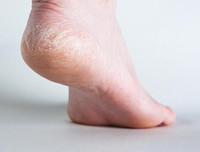 [ẢNH] Công dụng tuyệt vời của những loại vỏ tưởng chừng bỏ đi