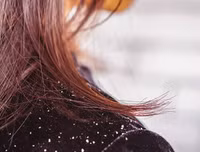 [ẢNH] Cảnh giác trước những hiểm họa từ thói quen để tóc ướt đi ngủ