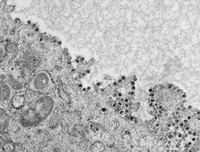 [ẢNH] Những con đường nhiễm bệnh không ngờ tới do virus corona gây ra