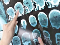 Những lợi ích tuyệt vời của trà không phải ai cũng biết