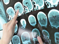 Những lợi ích tuyệt vời của trà không phải ai cũng biết