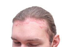 [ẢNH] Những tác hại đáng sợ do nhuộm tóc thường xuyên