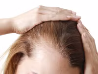 [ẢNH] Cảnh giác trước những hiểm họa từ thói quen để tóc ướt đi ngủ