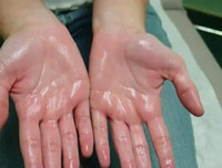 [ẢNH] 12 dấu hiệu bất thường trên cơ thể 