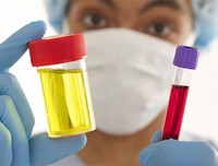 [ẢNH] Những dấu hiệu cảnh báo sớm bệnh sỏi thận bạn nên biết