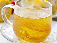 [ẢNH] Những dấu hiệu cảnh báo sớm bệnh sỏi thận bạn nên biết