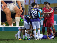 [ẢNH] Quế Ngọc Hải và những lần lĩnh án phạt nặng vì chơi thô bạo