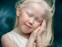 [ẢNH] Ngỡ ngàng trước vẻ đẹp khác biệt của những người mẫu bạch tạng nổi tiếng thế giới