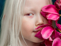 [ẢNH] Ngỡ ngàng trước vẻ đẹp khác biệt của những người mẫu bạch tạng nổi tiếng thế giới