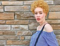 [ẢNH] Ngỡ ngàng trước vẻ đẹp khác biệt của những người mẫu bạch tạng nổi tiếng thế giới