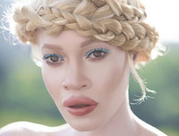 [ẢNH] Ngỡ ngàng trước vẻ đẹp khác biệt của những người mẫu bạch tạng nổi tiếng thế giới