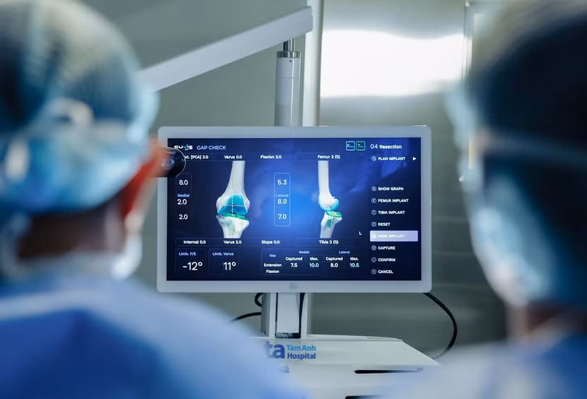 Phần mềm chuyên dụng của Robot CUVIS-Joint giúp bác sĩ kiểm tra và cân bằng tối ưu cấu trúc khớp, mô mềm và trục chi trong quá trình mổ