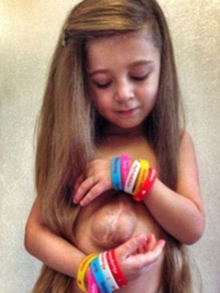 Cuộc sống đầy màu sắc của cô bé có trái tim nằm ở... bụng ảnh 1 Cuộc sống đầy màu sắc của cô bé có trái tim nằm ở... bụng ảnh 1