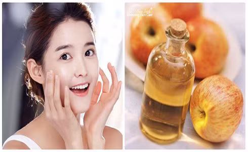 Công dụng hữu hiệu của giấm táo để chăm sóc da, tóc và giảm cân ảnh 1