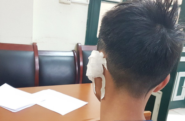 Do nợ nần, nam thanh niên mang dao rựa đi cướp xe máy ảnh 3