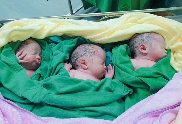 Hi Hữu: Sản phụ sinh 3 dù trước đó siêu âm nhiều lần chỉ sinh đôi ảnh 1