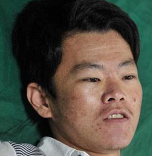 Nhói lòng nhìn người mẹ phân vân hiến thận cho 1 trong 2 đứa con ảnh 2