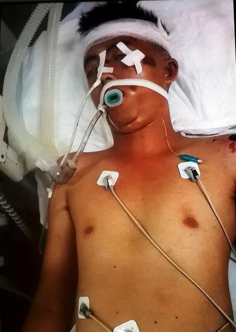 Tìm nhân thân nam thanh niên bị tai nạn nguy kịch ảnh 1 Tìm nhân thân nam thanh niên bị tai nạn nguy kịch ảnh 1