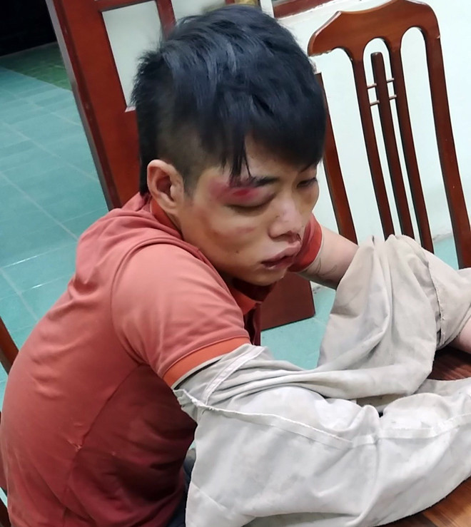 Hà Nội: Công an truy bắt đối tượng trong vụ trộm chó, chém người ở Quốc Oai ảnh 1 Hà Nội: Công an truy bắt đối tượng trong vụ trộm chó, chém người ở Quốc Oai ảnh 1