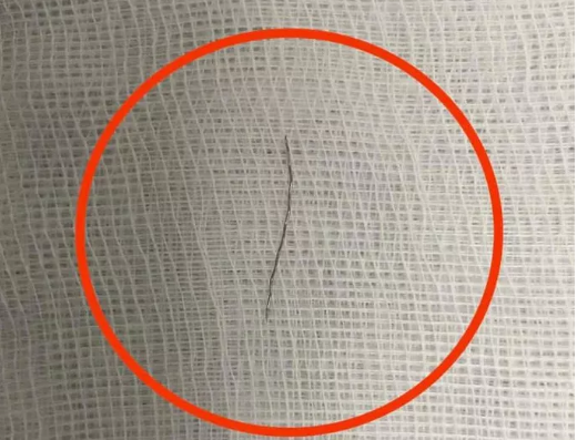 Ăn cháo mua sẵn, bé trai 13 tháng tuổi nuốt phải sợi thép ảnh 2